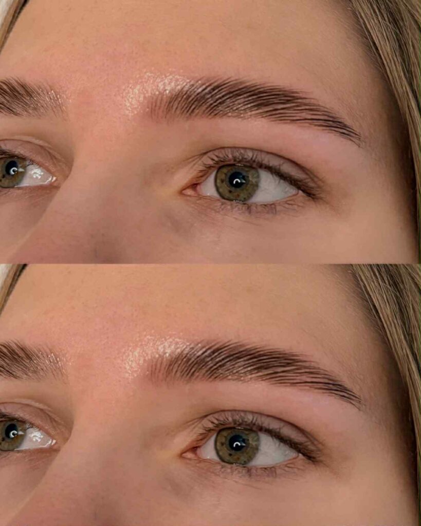 eyelash serum
